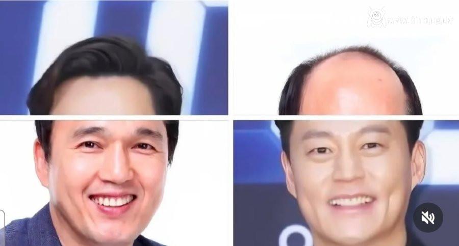 헤어의 중요성... 김광규 vs 이서진 1